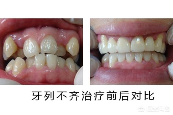迪庆最新24小时牙医在线咨询方法分析(最方便真实的迪庆有没有24小时牙医方法)