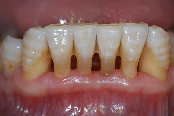 迪庆最新24小时牙医在线咨询方法分析(最方便真实的迪庆有没有24小时牙医方法)